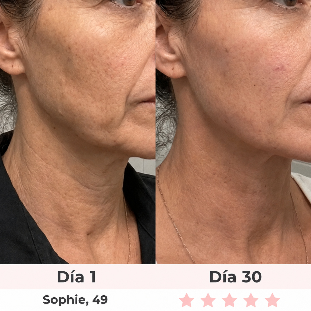 Masajeador Facial LED 7 en 1 Moditen