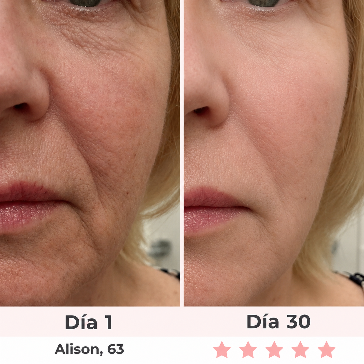 Masajeador Facial LED 7 en 1 Moditen