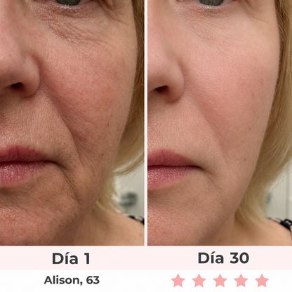 Masajeador Facial LED 7 en 1 Moditen