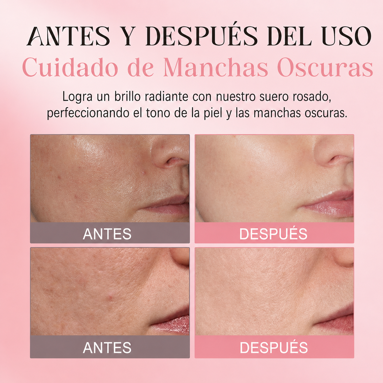 Sérum Facial Pink Glow con PDRN – Hidratación y Luminosidad
