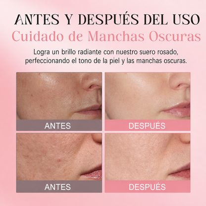 Sérum Facial Pink Glow con PDRN – Hidratación y Luminosidad
