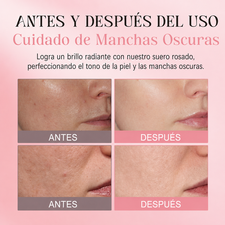 Sérum Facial Pink Glow con PDRN – Hidratación y Luminosidad
