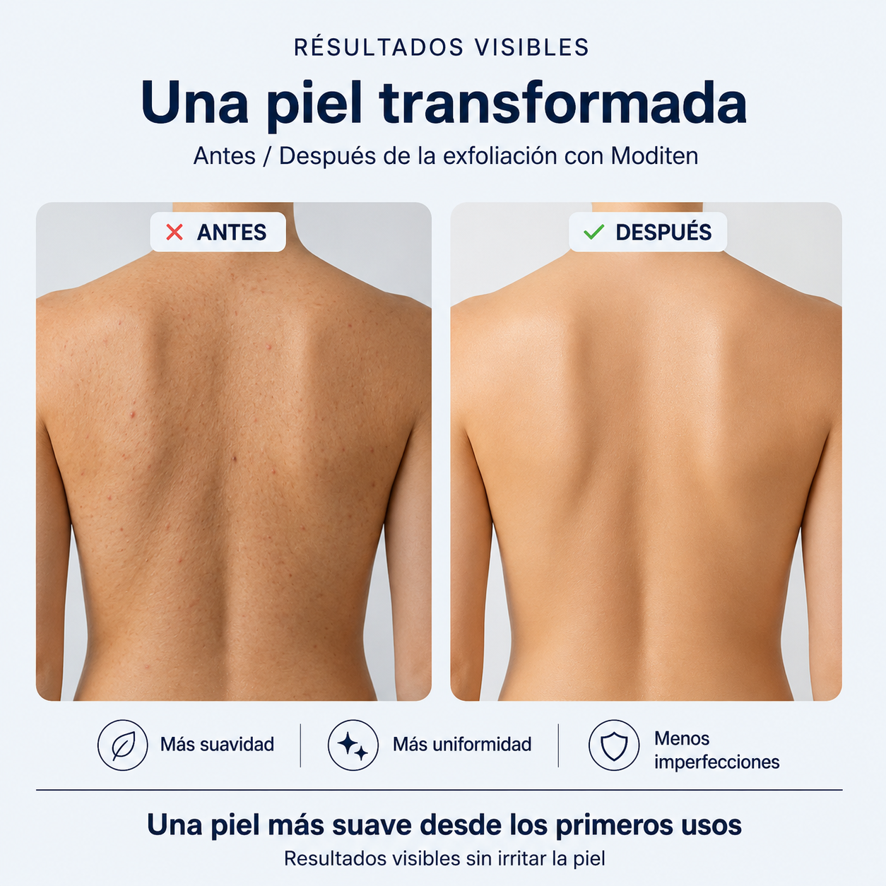 Toalla Exfoliante Corporal Moditen | Limpieza Profunda y Piel Suave